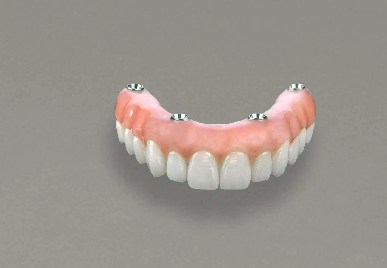 Proteza na implantach