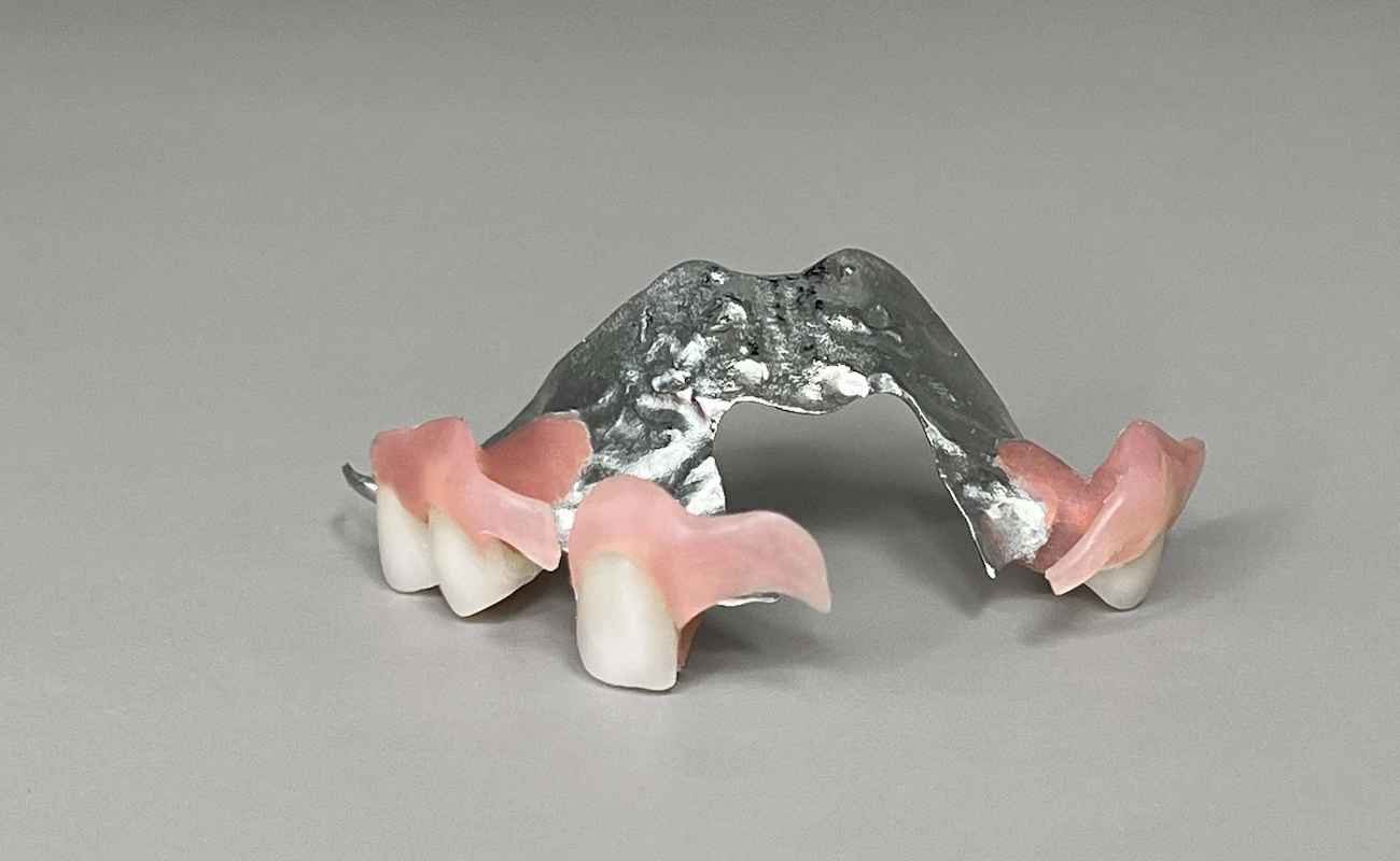 Proteza Hybrydowa (szkieletowo – acronowa)