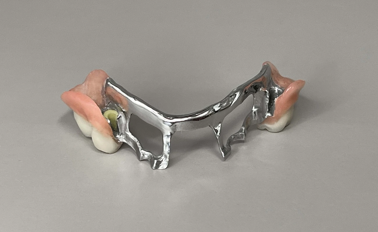 Proteza szkieletowa na zasuwach