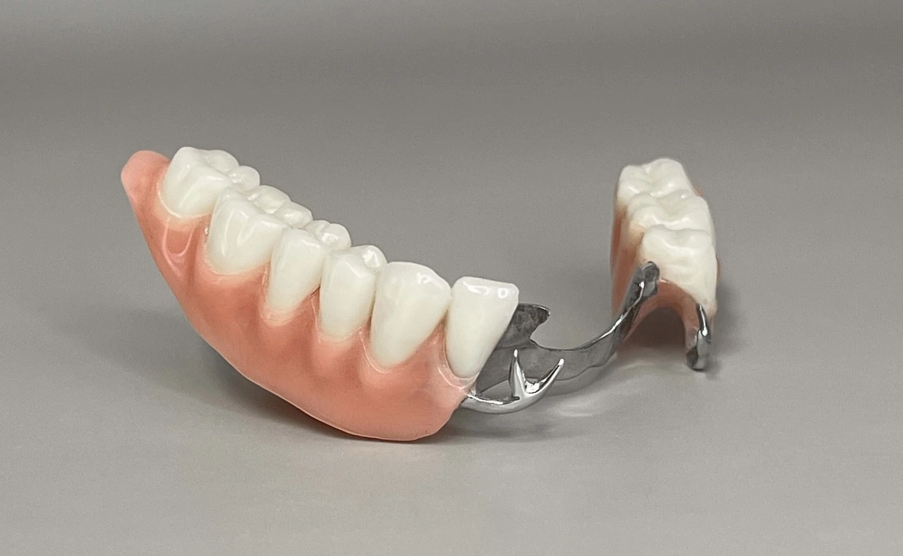 Proteza szkieletowa - protezy szkieletowe Katowice